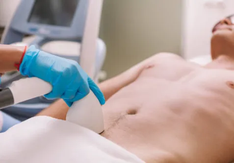 VIOのおすすめケア方法と選び方で安心してツルツルを目指すためのポイント